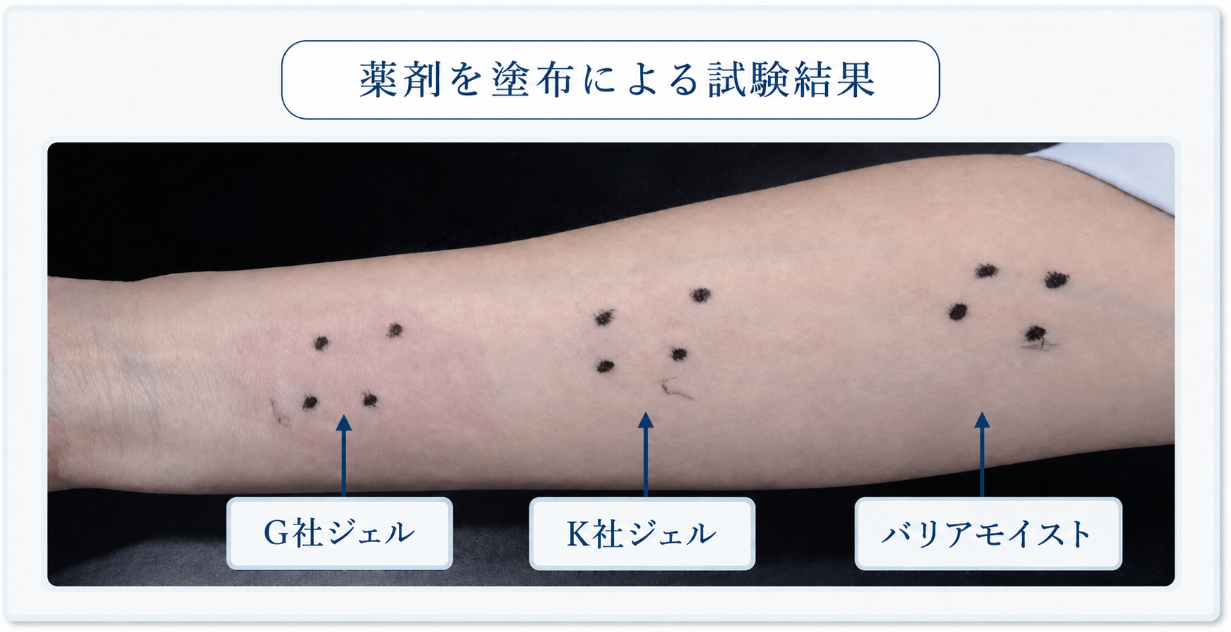 バリアモイストと他社ジェルの薬剤刺激試験結果